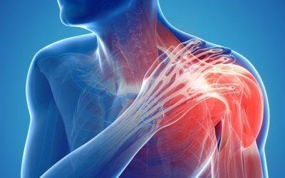 Illustration of shoulder pain highlighting musculoskeletal issues, relevant for orthopedic care.