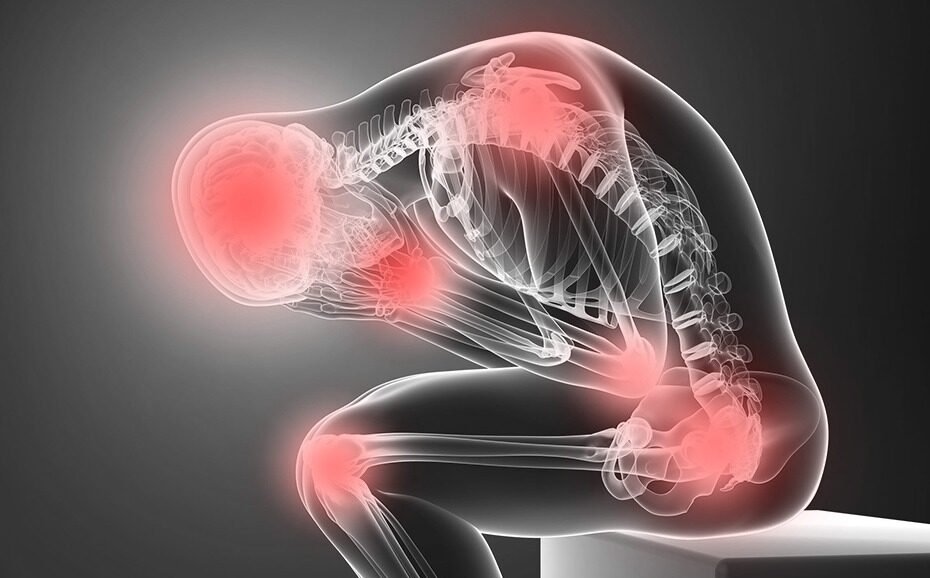 Digital representation of a human body highlighting areas of pain, used for cancer pain management.