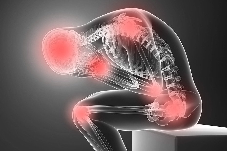 Digital representation of a human body highlighting areas of pain, used for cancer pain management.