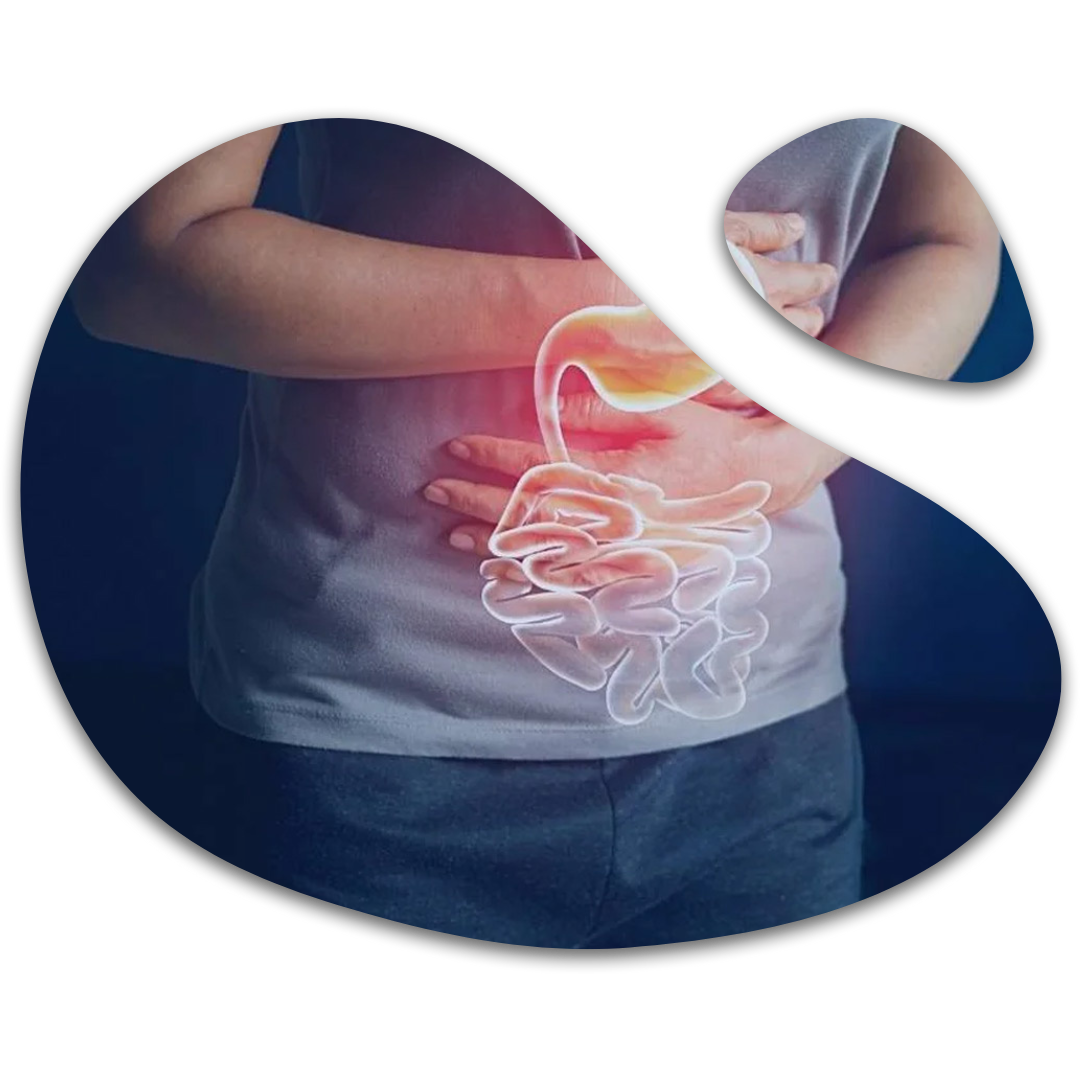 Illustration depicting symptoms of gastritis, including abdominal pain, bloating, nausea, and indigestion.