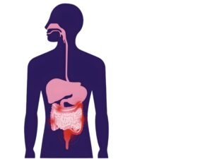 Illustration of the digestive system highlighting inflamed intestines, representing Irritable Bowel Syndrome treatment in Bhopal with a gastroenterologist in Bhopal